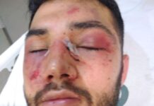 Fisioterapeuta é espancado por seguranças de tabacaria de Itapema