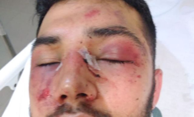 Fisioterapeuta é espancado por seguranças de tabacaria de Itapema