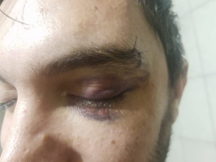 anderson-agressao-800x600