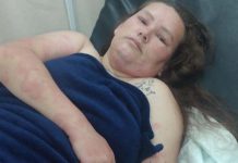 Mãe e filha se recuperam depois de um violento ataque de abelhas no centro de Penha
