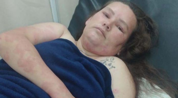 Mãe e filha se recuperam depois de um violento ataque de abelhas no centro de Penha