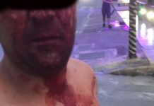 Esposa e homem agredido na pizzaria de Penha lutam por Justiça
