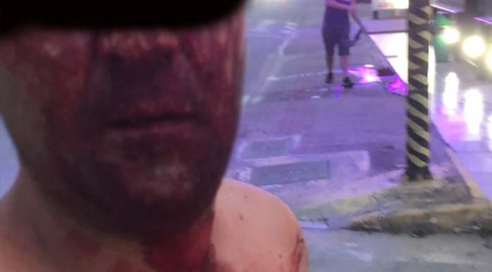 Esposa e homem agredido na pizzaria de Penha lutam por Justiça