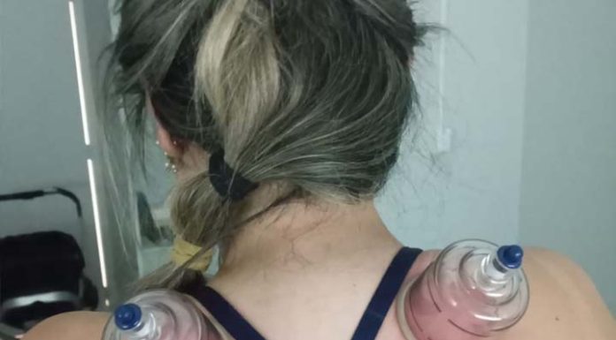 Você conhece a Ventosaterapia?