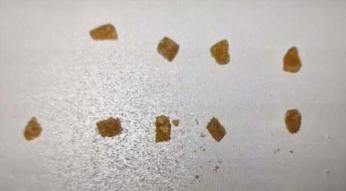 Grávida que escondia 13 pedras de crack no cabelo é presa pela polícia em Barra Velha