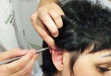 AURICULOTERAPIA: o que é, como funciona e suas indicações