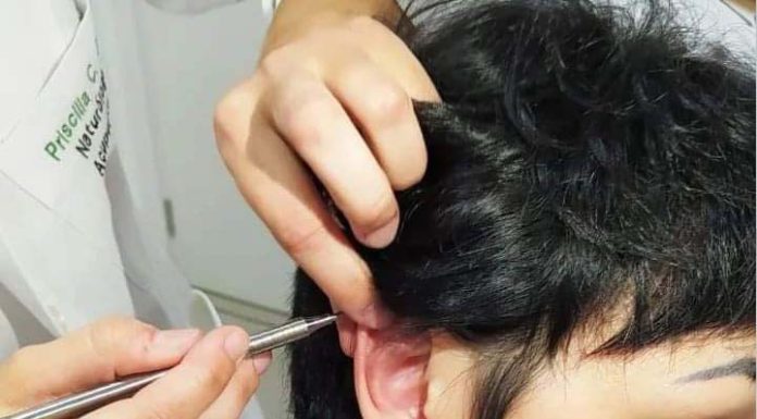 AURICULOTERAPIA: o que é, como funciona e suas indicações