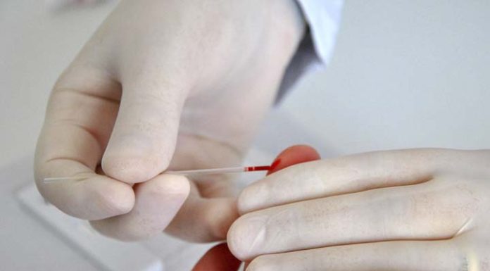 Secretaria de Saúde oferta teste rápidos de HIV em todas as Unidades Básicas