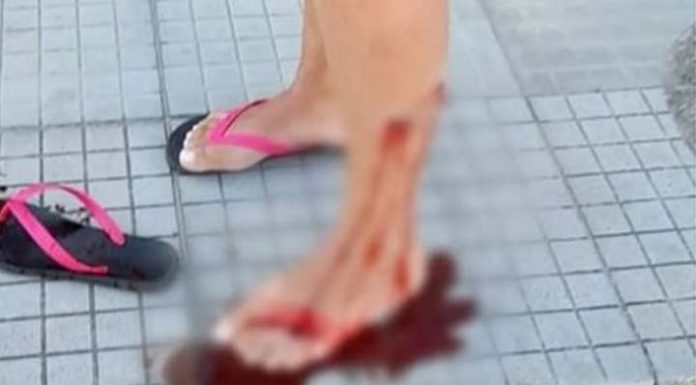 Justiça determina que prefeitura tome medidas de segurança contra animais soltos na rua