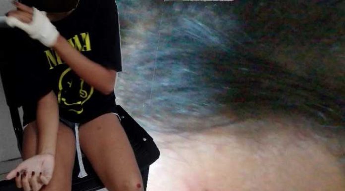 Adolescente é agredida na saída da escola municipal Monteiro Lobato em Piçarras