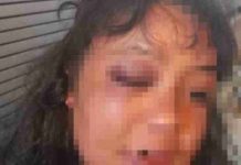 Mulher cai na porrada com morador de rua em Itapema