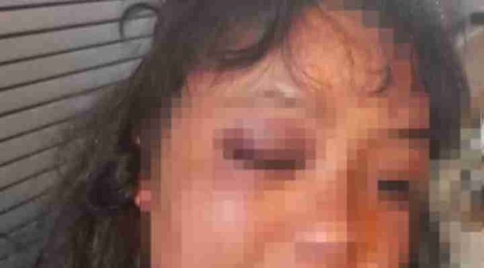 Mulher cai na porrada com morador de rua em Itapema