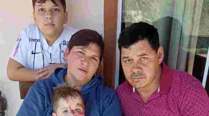 Menino de dois anos atropelado pelo pai em Barra Velha se recupera e emociona a família