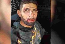“Caiu sozinho”: ladrão é preso após ser flagrado por moradores de Itapema
