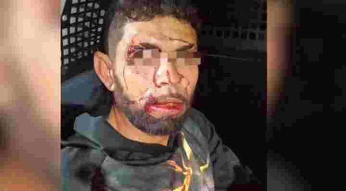 “Caiu sozinho”: ladrão é preso após ser flagrado por moradores de Itapema