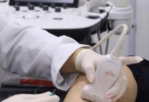 Tratamento de varizes por espuma é oferecido pelo SUS no município de Penha