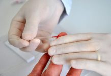 Julho Amarelo: Penha oferece testes rápidos de hepatites virais