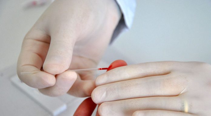 Julho Amarelo: Penha oferece testes rápidos de hepatites virais