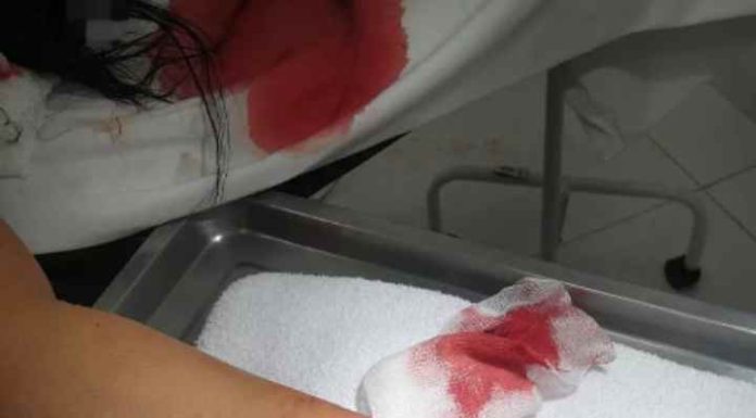 Jovem leva diversas facadas do marido durante churrasco em Bombinhas