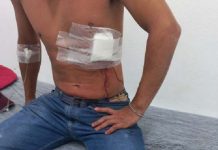 Jovem paranaense é esfaqueado misteriosamente em Bombinhas