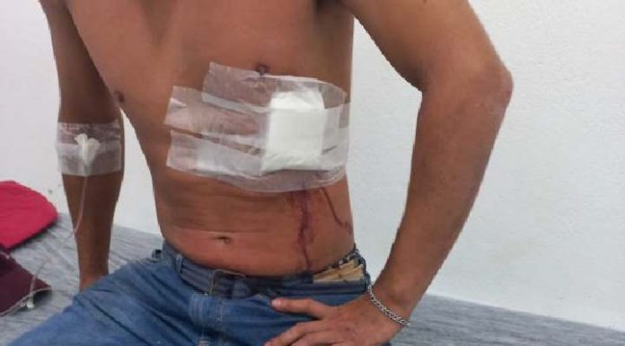 Jovem paranaense é esfaqueado misteriosamente em Bombinhas