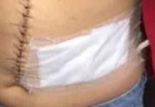 Dois homens são esfaqueados no abdomem durante briga de bar em Barra Velha