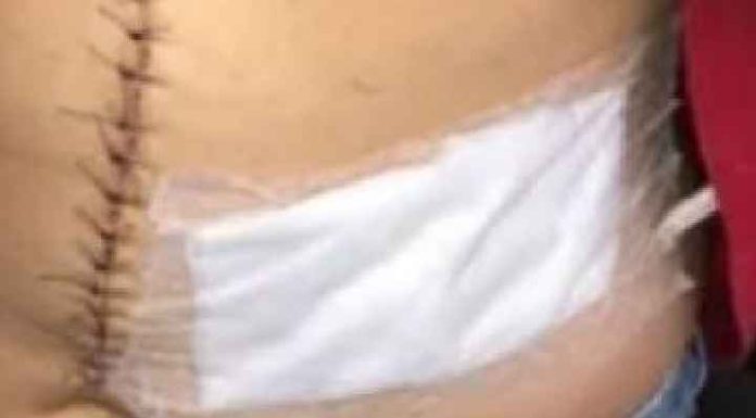 Dois homens são esfaqueados no abdomem durante briga de bar em Barra Velha