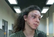 Ator é espancado a socos na entrada de um edifício de classe alta