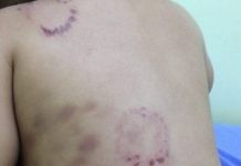 Pais são presos por suspeita de torturar o filho de 3 anos
