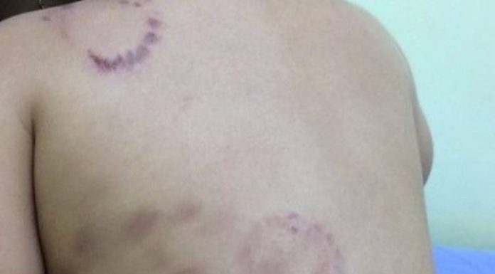 Pais são presos por suspeita de torturar o filho de 3 anos