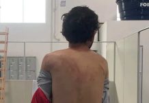 Pessoas em situação de rua são agredidas e escoltadas para fora de Itajaí em ação de PMs à revelia