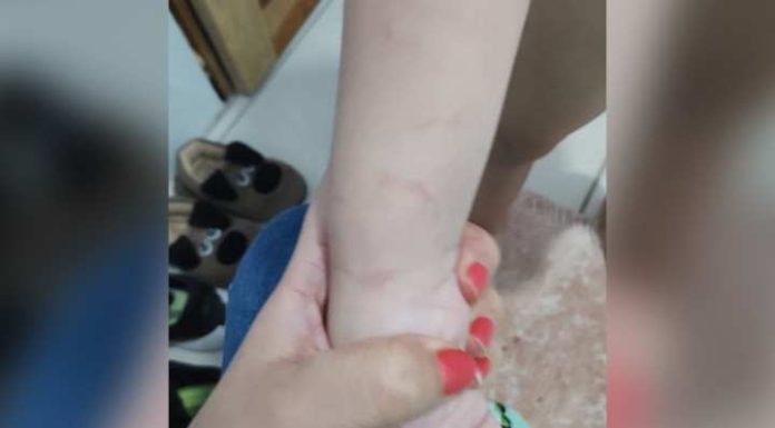 Professora é afastada após arrastar criança autista em escola de SC