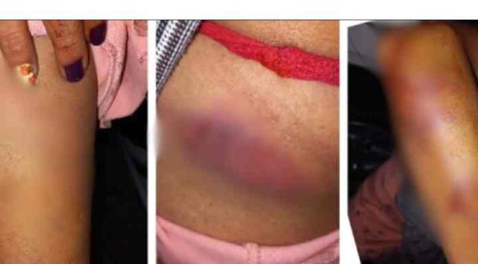 Mulher é espancada pelo marido com barra de ferro em Nova Trento