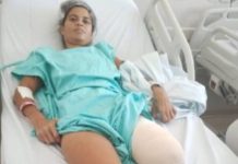 Mãe de seis filhos de Penha precisa de ajuda após acidente e amputação de perna