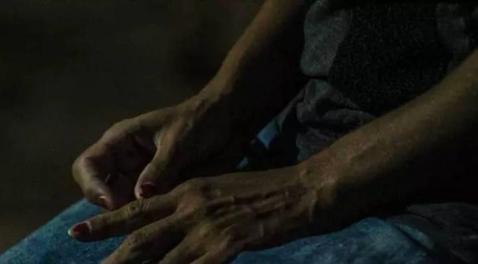 Mãe sente culpa por deixar o ex quebrar a perna do filho de 4 anos