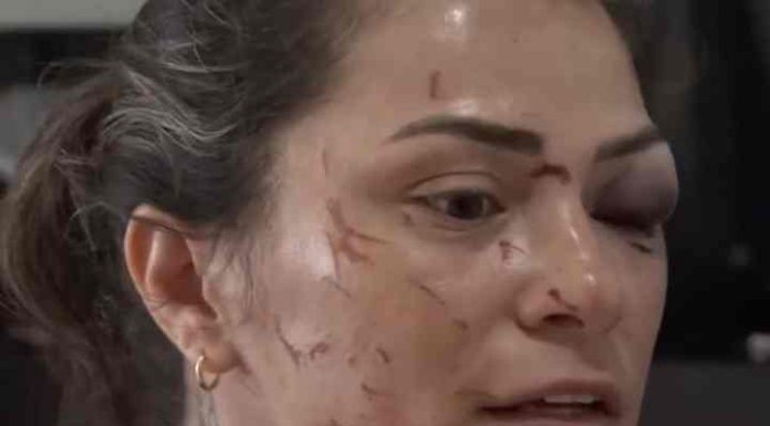 Mulher se revolta ao denunciar que foi espancada pelo ex-marido em SC