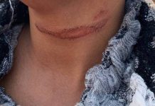Motorista de aplicativo é jogada desacordada na Ponta da Vigia em Penha