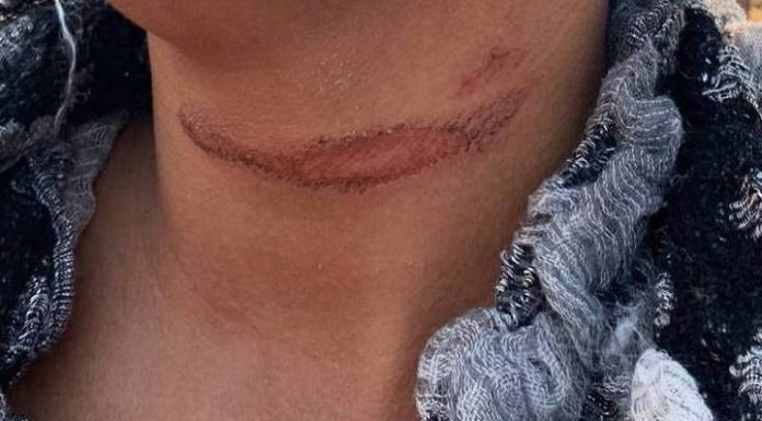 Motorista de aplicativo é jogada desacordada na Ponta da Vigia em Penha