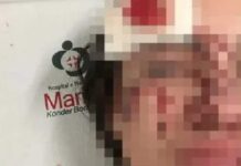 Aluna é espancada na saída da Univali em Itajaí
