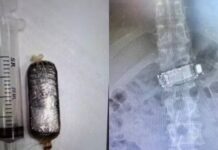 Celular fica atravessado em sistema digestório após detento engolir aparelho em SC
