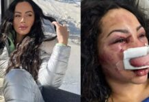 Brasileira é cruelmente espancada em assalto no Chile