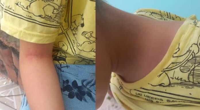 Aluno autista é isolado após mãe denunciar suspeitas de negligência