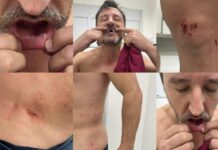 Marido de pré-candidata a prefeita do PL de Bombinhas é brutalmente agredido em festa