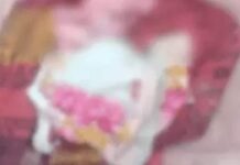 Bebê com quatro braços, quatro pernas e dois rostos morre poucas horas após o nascimento
