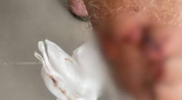 Idoso é atacado por 8 cães em Bombinhas