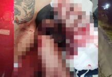 Homem quase tem braço amputado após queda no Bairro Santa Lídia, em Penha
