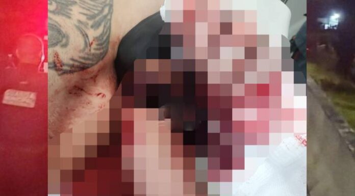 Homem quase tem braço amputado após queda no Bairro Santa Lídia, em Penha