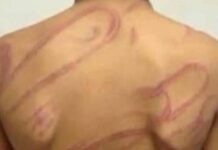 Menino com TDAH é agredido a chicotadas pela mãe e pede socorro ao pai em SC