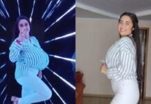Mulher que teria os maiores seios naturais do Brasil retira 10 kg de mamas: ‘Um alívio’