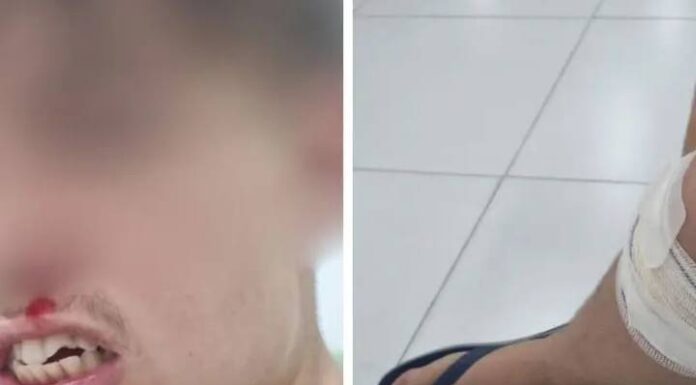 Adolescente é atropelado por carro do Conselho Tutelar em SC